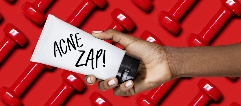 acne zap